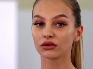 Saskia: „Ich habe bei meinen Lippen etwas nachgeholfen“