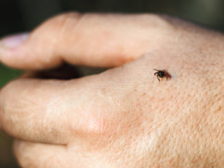 Experten warnen! So schützt Du dich vor Zecken