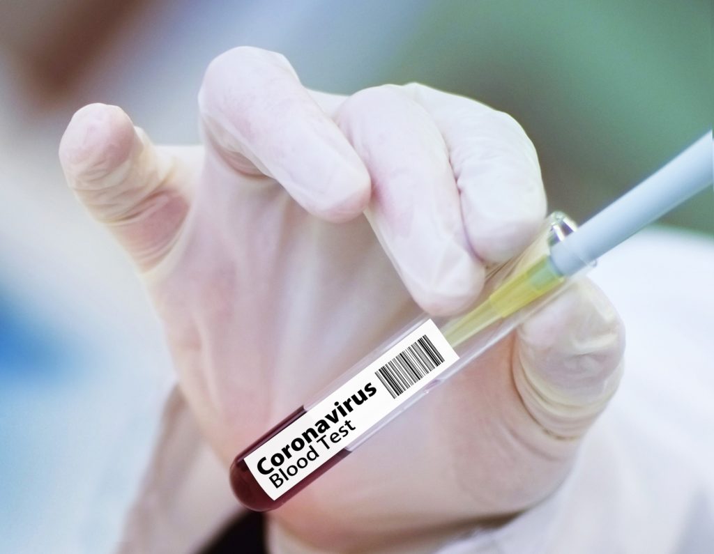 Symbolbild: Coronavirus-Test