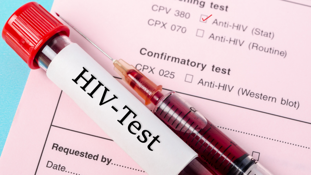 Symbolbild: HIV-Test