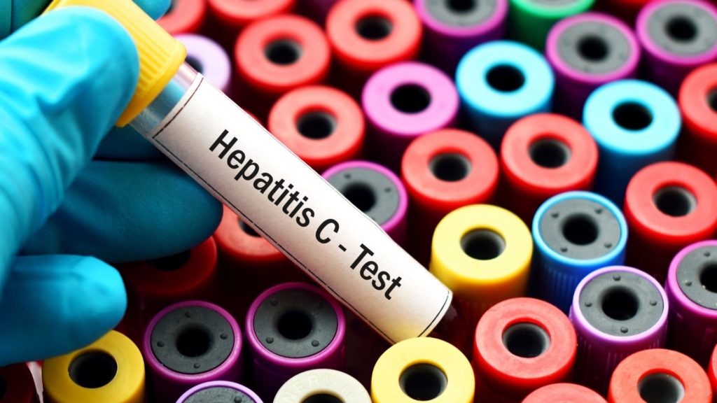 Symbolbild: Hepatitis-C-Test