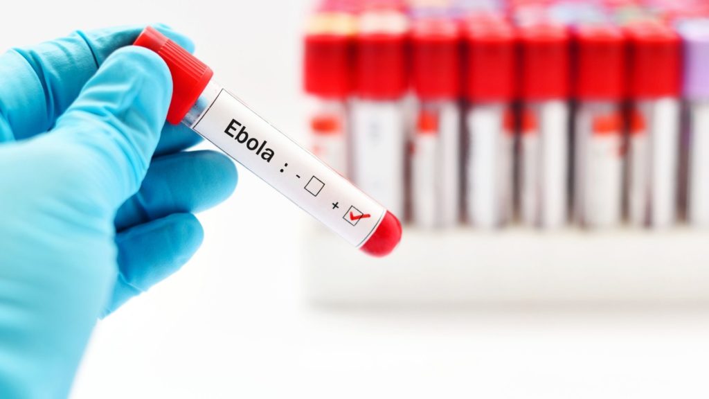 Ebola-Test