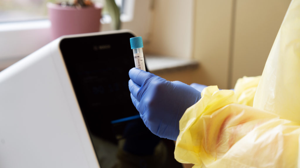 PCR-Test-Auswertung - Bild: Bosch