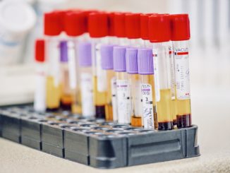 RKI meldet am Samstag 12.321 Corona-Neuinfektionen und 794 Todesfälle – Inzidenz sinkt weiter auf 90,9