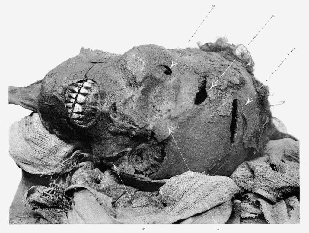 Mumifizierter Kopf von Pharao Seqenenre Taa - Bild: G. Elliot Smith, Public domain, via Wikimedia Commons