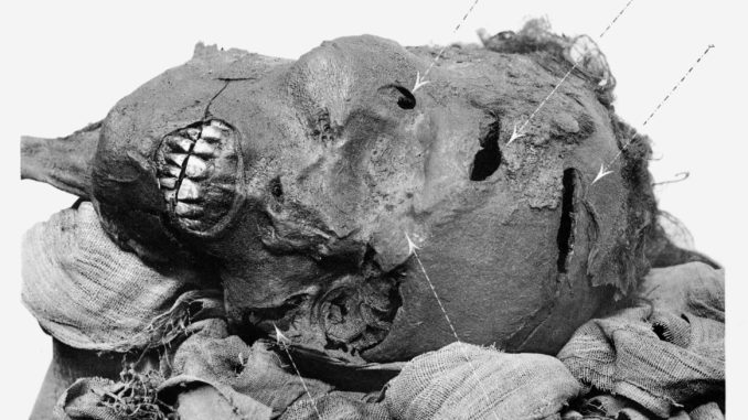 Mumifizierter Kopf von Pharao Seqenenre Taa - Bild: G. Elliot Smith, Public domain, via Wikimedia Commons