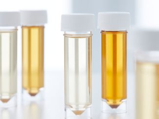 Britische Forscher entwickeln Urintest zum Aufspüren von Gebärmutterkrebs