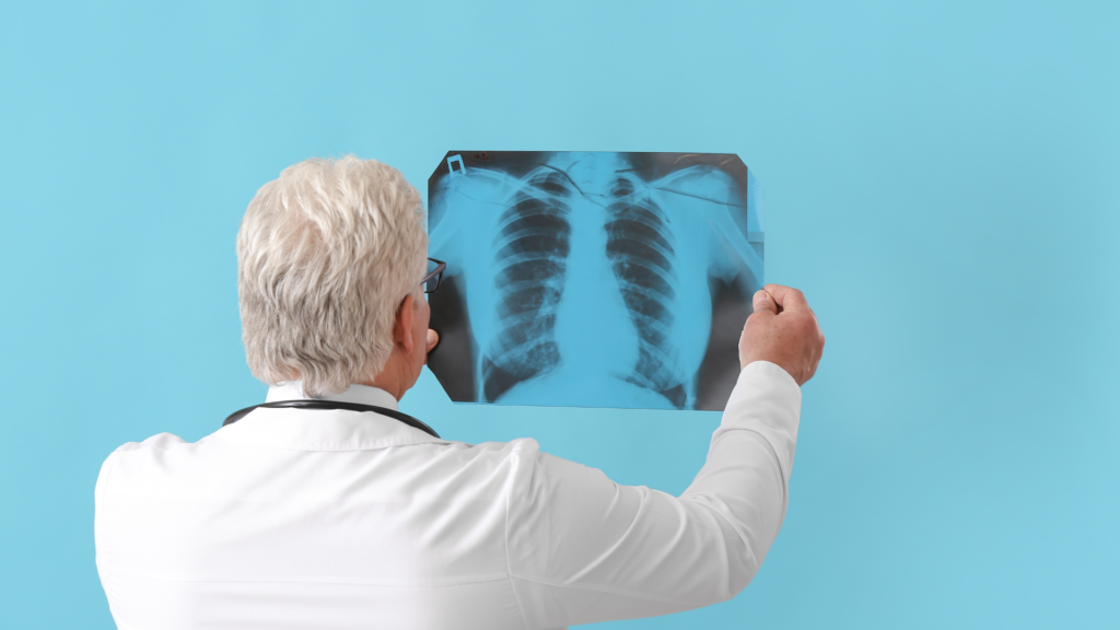 Röntgenaufnahme einer Lunge