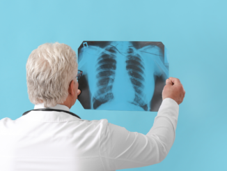 Wissenschaft sicher: Ja! Wir können die Tuberkulose beenden!