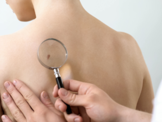 Zahl stationärer Hautkrebsbehandlungen stark gestiegen