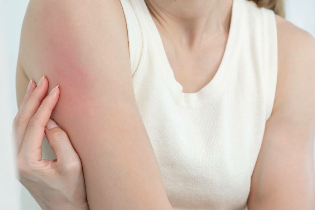 Reibeisenhaut ausdrücken: Warum das keine gute Idee ist