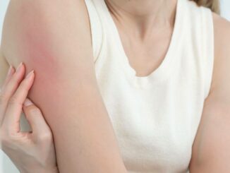 Reibeisenhaut ausdrücken: Warum das keine gute Idee ist