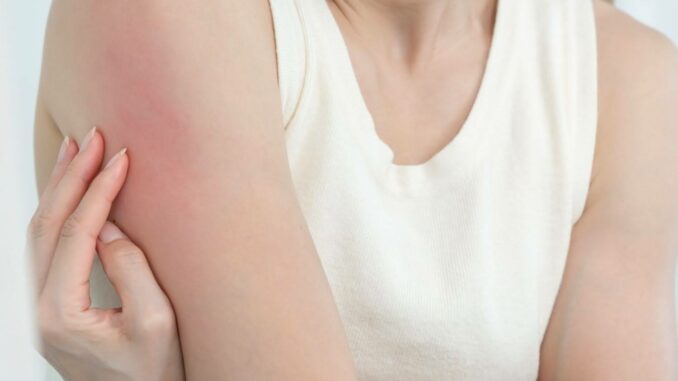 Reibeisenhaut (über bestnj)